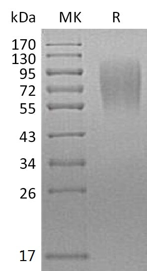 Recombinant Mouse LAMP-1 (C-6His)