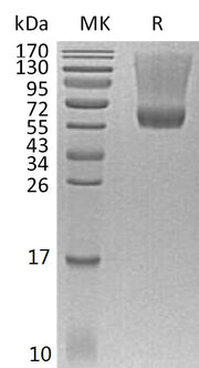 Recombinant Human Decorin (C-6His)