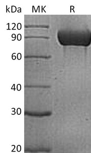 Recombinant Human PECAM-1 (C-6His)