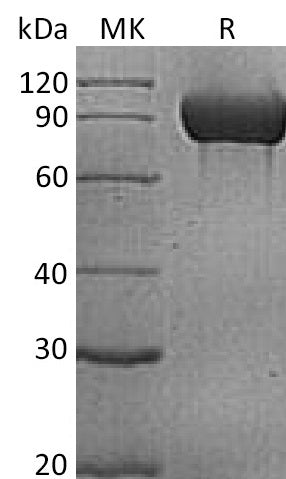Recombinant Human PECAM-1 (C-6His)