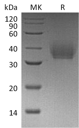 Recombinant Mouse IL-21R (C-6His)