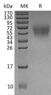 Recombinant Human DNAM-1 (C-6His)