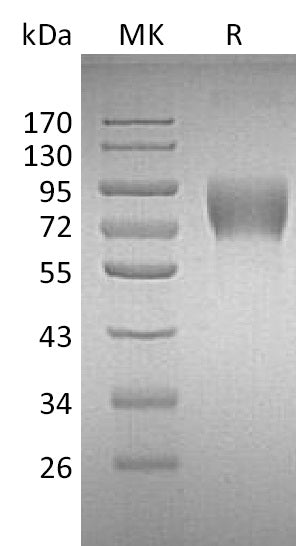 Recombinant Human DNAM-1 (C-Fc)
