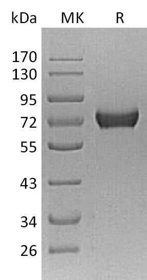 Recombinant Mouse AFP (C-10His)