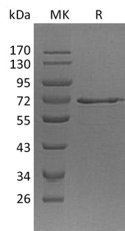 Recombinant Human MetAP2 (N-6His)