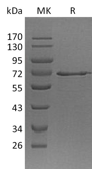 Recombinant Human MetAP2 (N-6His)