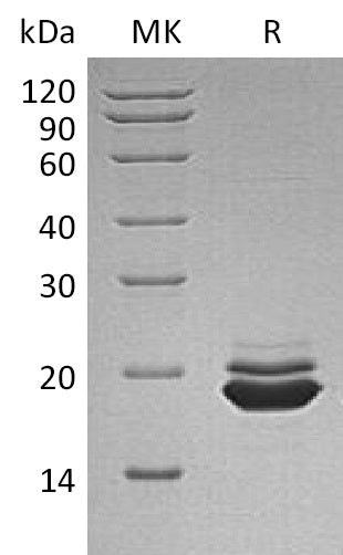 Recombinant Human APLP-1 (C-6His)