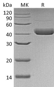 Recombinant Human Decorin (C-6His, Baculovirus)