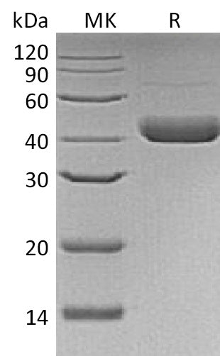 Recombinant Human Decorin (C-6His, Baculovirus)