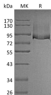Recombinant Mouse Thrombomodulin (C-6His)