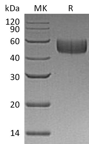 Recombinant Human SIRPB1 (C-6His)