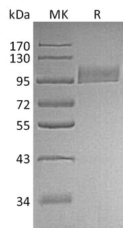 Recombinant Human Neprilysin (N-8His)