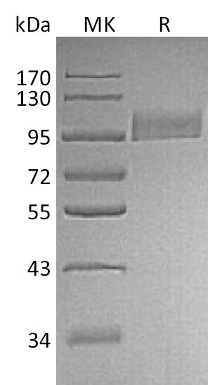 Recombinant Human Neprilysin (N-8His)