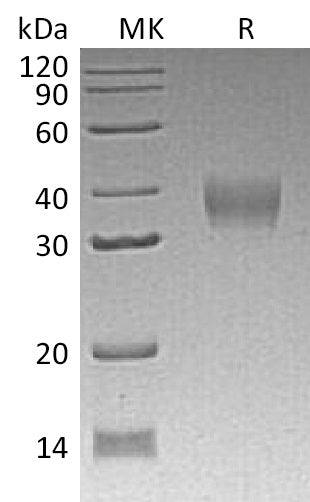 Recombinant Mouse LILRB4 (C-6His)