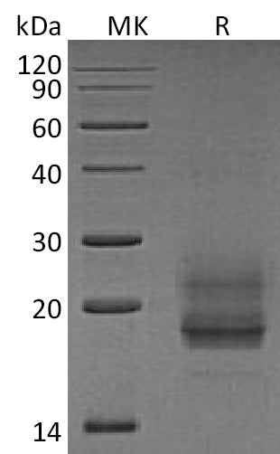 Recombinant Human CD69 (N-8His)