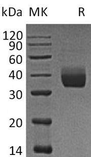 Recombinant Human LILRA5 (C-6His)