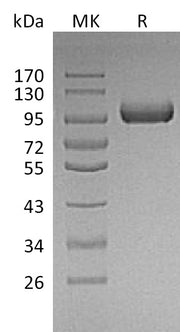 Recombinant Mouse LRIG1 (C-6His)