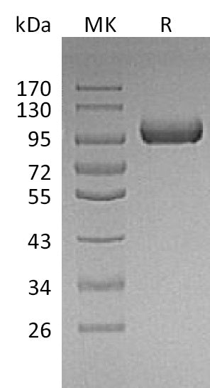 Recombinant Mouse LRIG1 (C-6His)