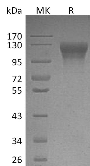 Recombinant Human LEPR (C-10His)