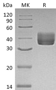 Recombinant Mouse CD157 (C-6His)