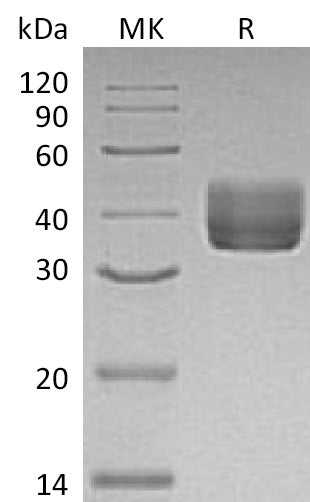 Recombinant Mouse CD157 (C-6His)