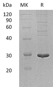 Recombinant Human PDIA5 (C-6His)