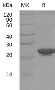 Recombinant Human NGAL (C-6His, Human Cells)