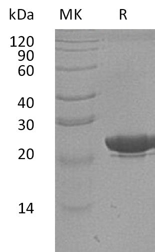 Recombinant Human NGAL (C-6His, Human Cells)