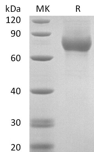 Biotinylated Human LRRC15 (C-6His-Avi)