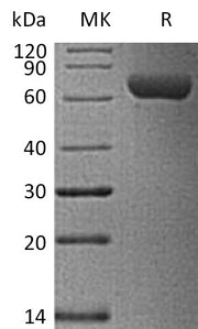 Biotinylated Human ROR1 (C-6His-Avi)