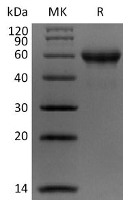 Biotinylated Human Carbonic Anhydrase 9 (C-Avi-6His)