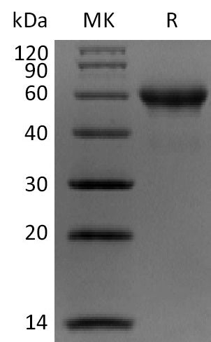 Biotinylated Human Carbonic Anhydrase 9 (C-Avi-6His)