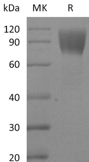 Biotinylated Human CA125 (C-Fc-Avi)