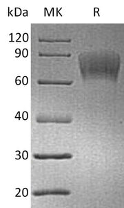 Biotinylated Human CD30 (C-6His-Avi)