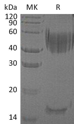 Recombinant Human Haptoglobin (C-6His)