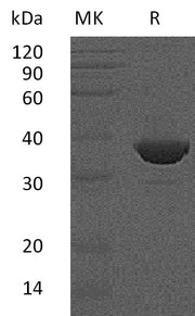 Recombinant Human FBPase1 (C-6His)
