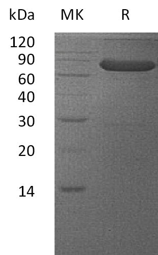 Recombinant Human VSIG4 (C-Fc)
