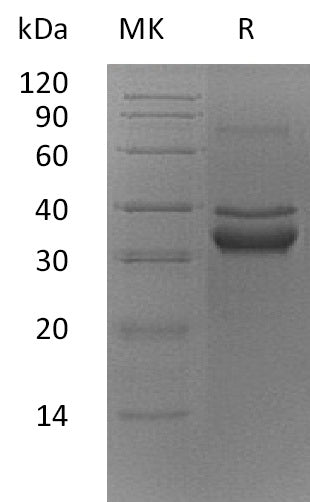 Recombinant Mouse TWEAK R (C-Fc)