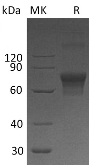 Recombinant Human TIM-3 (C-Fc-6His)