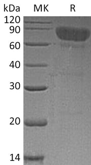 Recombinant Human TCblR (C-Fc)
