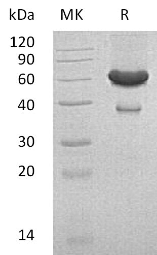 Recombinant Mouse EFNA1 (C-Fc-6His)