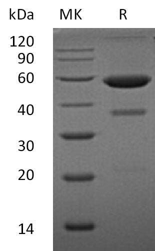 Recombinant Human EFNA1 (C-Fc)