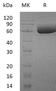 Recombinant Human SMPDL3A (C-6His)
