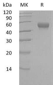 Recombinant Human LRG1 (C-6His)