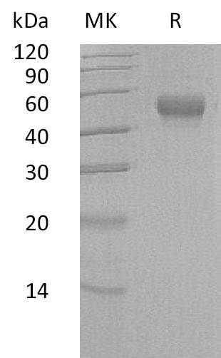 Recombinant Human LRG1 (C-6His)