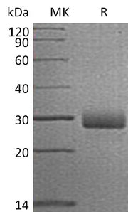 Recombinant Human RTBDN (C-6His)