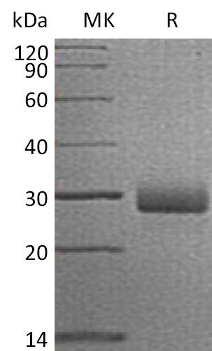 Recombinant Human RTBDN (C-6His)