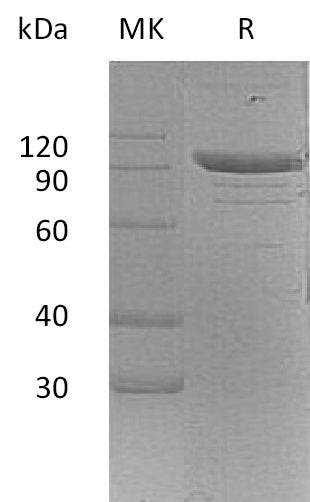 Recombinant Mouse PSGL-1 (C-Fc)