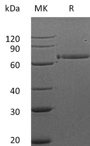 Recombinant Human HER3 (312AA, C-Fc)