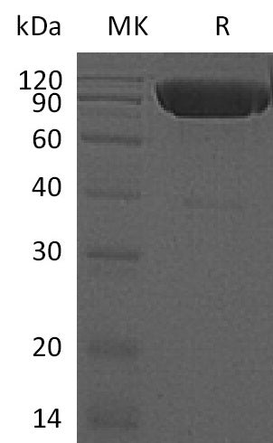 Recombinant Mouse DR6 (C-Fc-6His)